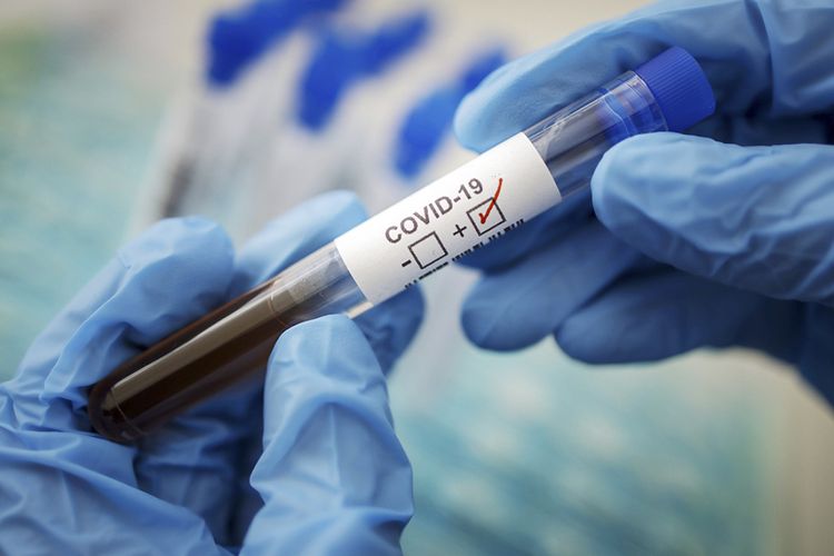 Almaniyada son sutkada 1 147 nəfər koronavirusa yoluxub