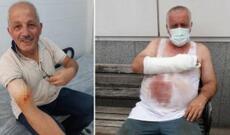 Trabzonda qurban kəsimi: bələdiyyə başqanı da daxil olmaqla 127 nəfər yaralandı