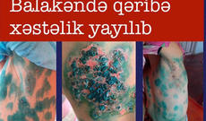 Nazirlikdən sosial şəbəkələrdə yayılan bu məlumata - Cavab