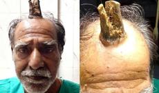 74 yaşlı kişi buynuz çıxardı - ŞOK HADİSƏ