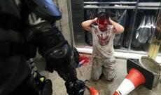 Honkonqda millət vəkilinin qulağını dişlədilər - Video