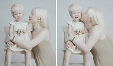 Model dünyasını fəth edən albinos bacılar - Fotolar