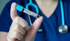 Xarici ölkələrdə 32 Türkiyə vətəndaşı koronavirusdan ölüb