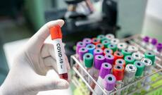 Dünyada koronavirusdan ölənlərin sayı 96 minə yaxındır