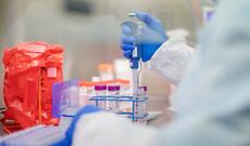 ÜST: Koronavirus laboratoriyada hazırlanmayıb