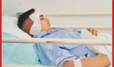 Avropada  nadir xəstəlikdən 230 uşaq ölüb