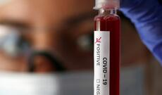 Azərbaycanda yeni koronavirusun 2-ci dalğası başlayıb: 136 yoluxma, 3 ölü