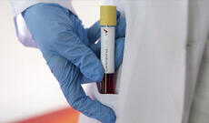 Rusiyada bir gündə 9268 nəfər koronavirusa yoluxdu