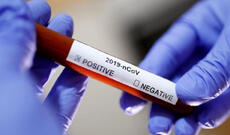 Ukraynada 4621 tibb işçisi koronavirusa yoluxdu