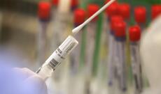 ÜST: Gələn ilin ortalarında koronavirusa qarşı peyvənd kütləvi istifadəyə hazır ola bilər