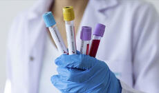 Rusiyada daha 5842 nəfər koronavirusa yoluxdu