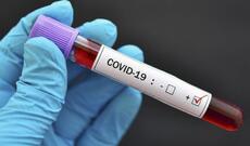 Rusiyada son sutkada 5 159 nəfər COVID-19-a yoluxub