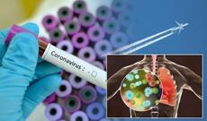 Azərbaycanda koronavirus infeksiyasına 87 yeni yoluxma aşkarlanıb