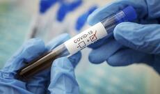 Azərbaycanda koronavirus (COVID-19) infeksiyasına 89 yeni yoluxma faktı qeydə alınıb