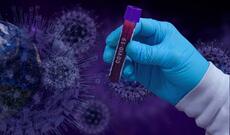 Azərbaycanda koronavirus infeksiyasına 175 yeni yoluxma faktı qeydə alınıb