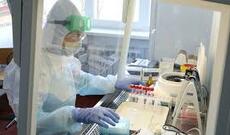Azərbaycan Respublikasında koronavirus (COVID-19) infeksiyasına 191 yeni yoluxma faktı qeydə alınıb
