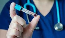 Azərbaycanda son sutkada 277 nəfər COVID-19-a yoluxub