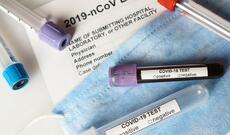 Azərbaycanda daha 1 175 yoluxma faktı qeydə alınıb