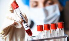 Son sutkada  1 364  yeni yoluxma faktı qeydə alınıb