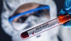 Azərbaycanda günün koronavirus statistikası: 2 259 yeni yoluxma, 21 ölüm faktı...