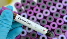 Milli Məclisin deputatları koronavirusa yoluxub