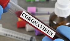 Azərbaycanda koronavirus (COVID-19) infeksiyasına 3712 yeni yoluxma faktı qeydə alınıb