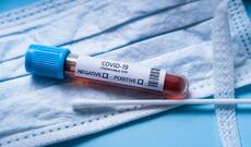 Azərbaycanda koronavirusa 4 077 yeni yoluxma qeydə alınıb