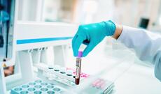 Hazırda koronavirusun müalicəsi üçün dərman yoxdur