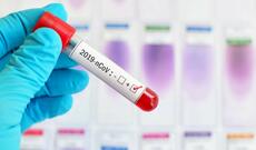 Azərbaycanda koronavirusdan daha 42 nəfər öldü