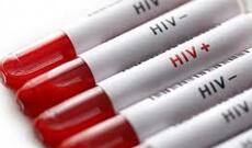 Nikaha daxil olmaq istəyən 540 nəfərdə sifilis, 110 şəxsdə QİÇS aşkarlanıb