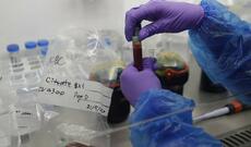 Tokio-2020: Daha 21 nəfərdə koronavirus aşkarlanıb