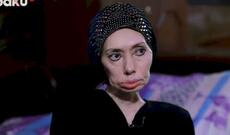 Ayna Sultanovanın nəticəsi: “Erməni tibb bacısı məni əlil etdi” - Video