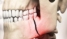 Musiqiçinin çənə sümüyünü sındırdılar