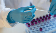 Olimpiadada 40-dan çox idmançı COVID-ə yoluxdu - ÜST