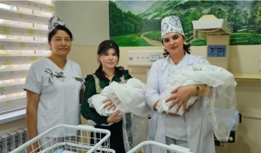 Özbəkistanda vaxtından əvvəl doğulan bitişik əkizləri  uğurlu əməliyyatla biri-birlərindən ayırıblar
