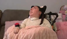 Beyinsiz doğulan qız həkimlərin proqnozlarına baxmayaraq 20 il yaşadı