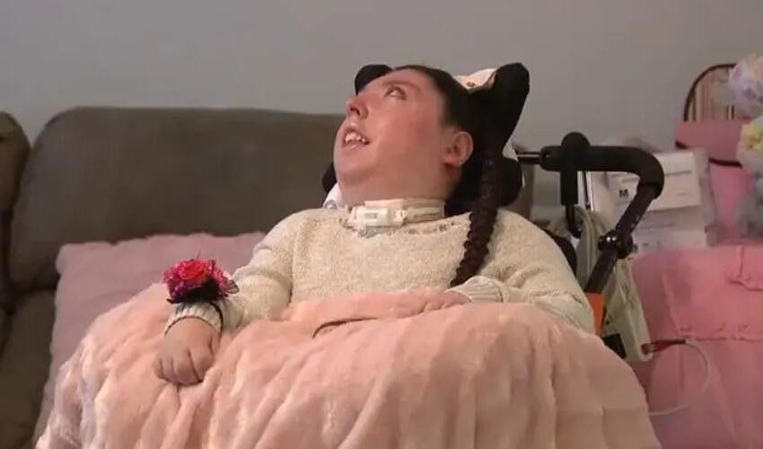 Beyinsiz doğulan qız həkimlərin proqnozlarına baxmayaraq 20 il yaşadı