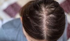 Çinli kişi arvadının keçəlliyinə görə boşanıb