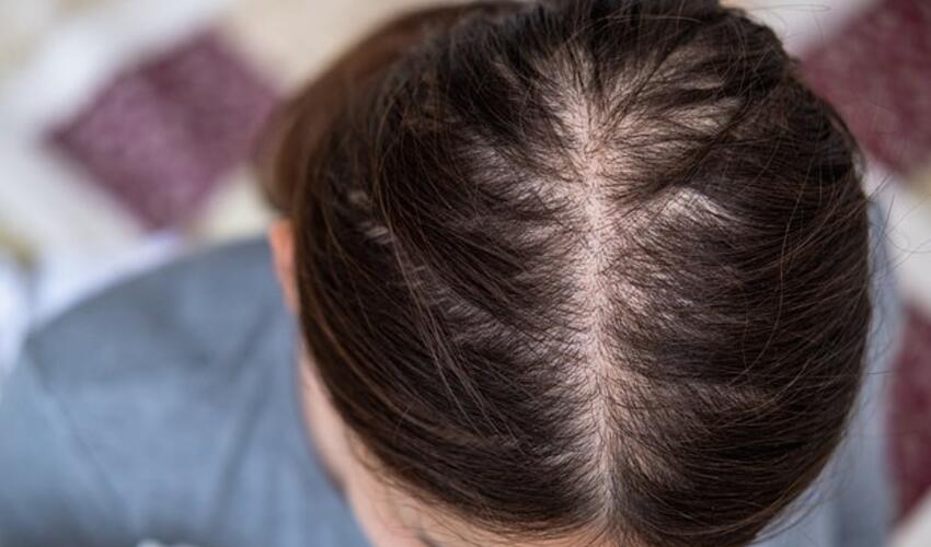 Çinli kişi arvadının keçəlliyinə görə boşanıb