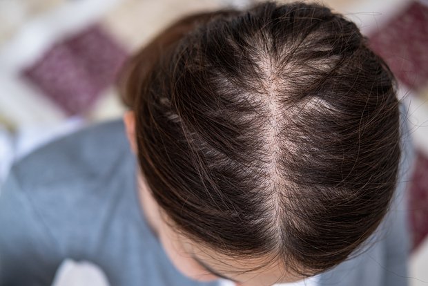 Çinli kişi arvadının keçəlliyinə görə boşanıb