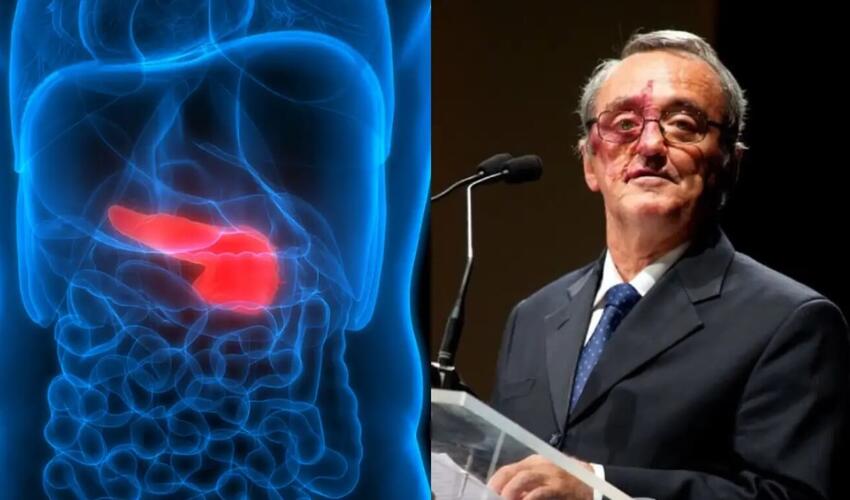 İspaniyalı alimlər mədəaltı vəzi xərçənginin müalicəsində irəliləyiş əldə etdiklərini açıqlayıblar