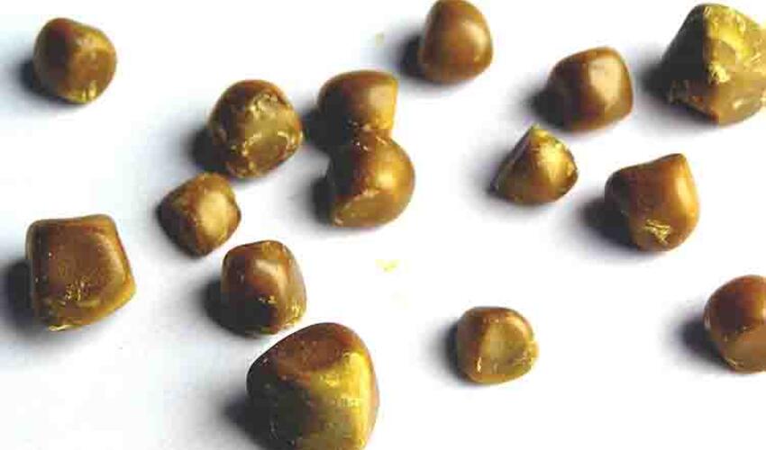 Rusiyalılar böyrək daşlarını satmağa başlayıblar