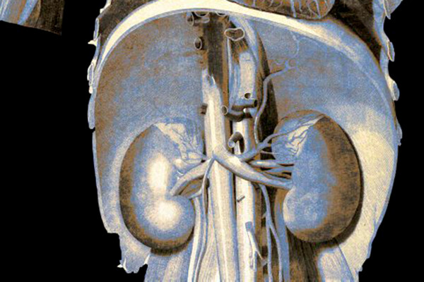 COVID-19-dan sağalan insanlarda  və ona qarşı peyvənd vurulan insanlarda böyrək zədələnməsi, infarkt  riski 2,3 dəfə artıb