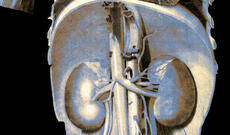 COVID-19-dan sağalan insanlarda və ona qarşı peyvənd vurulan insanlarda böyrək zədələnməsi, infarkt riski 2,3 dəfə artıb