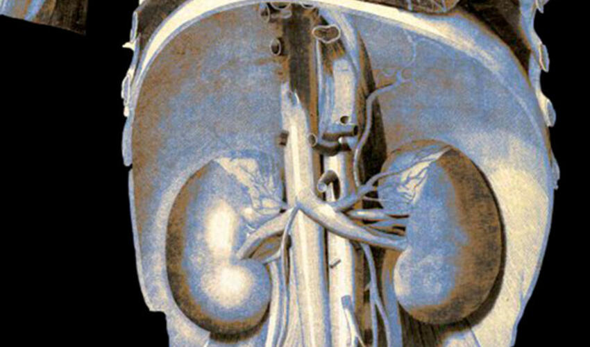 COVID-19-dan sağalan insanlarda  və ona qarşı peyvənd vurulan insanlarda böyrək zədələnməsi, infarkt  riski 2,3 dəfə artıb
