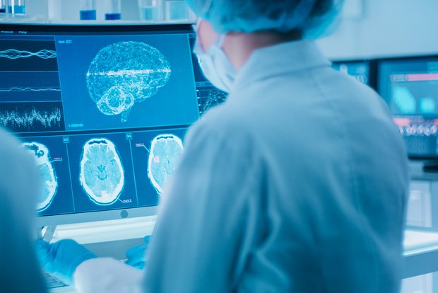 Beyin metastazları ilə mübarizə metodu aşkarlandı