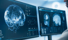 Alimlər beyin travmalarını bağırsaq vasitəsilə müalicə etməyi təklif ediblər