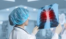 Alimlər vərəm bakteriyalarını "özünü məhv etməyə" məcbur etməyin yolunu tapıblar