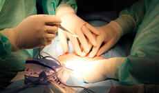 Ulan-Udedə həkimlər mədəsində daş olan gavalı həvəskarını xilas ediblər