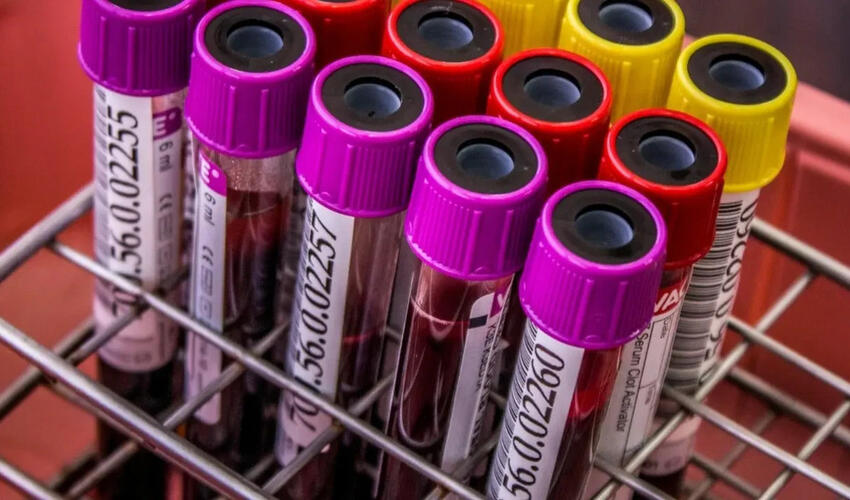 Prokurorlar narkotik işində Türkiyə məşhurlarının test nəticələrini  açıqlayıblar